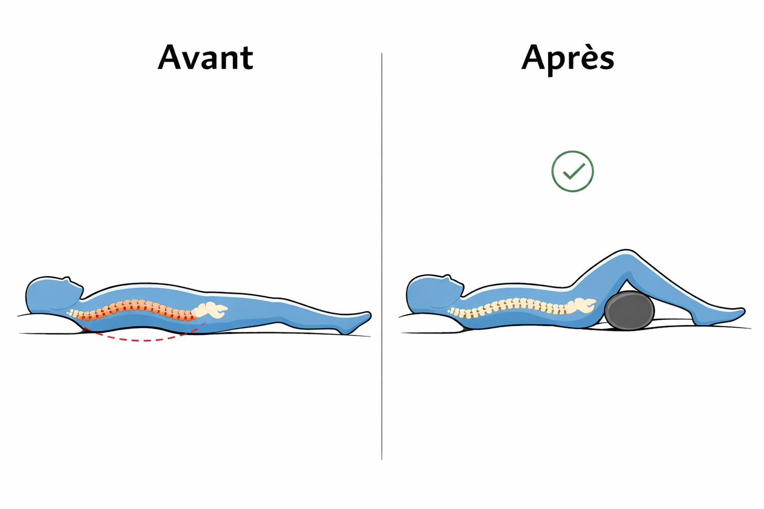 Comparaison avant après avec coussin cylindrique sous les genoux montrant un meilleur alignement de la colonne vertébrale en position allongée sur le dos